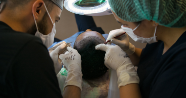 Hair Transplant 3 Days Workshop